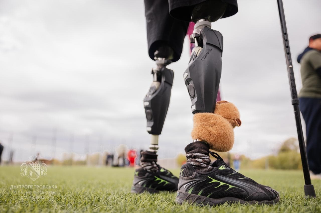 Протезування